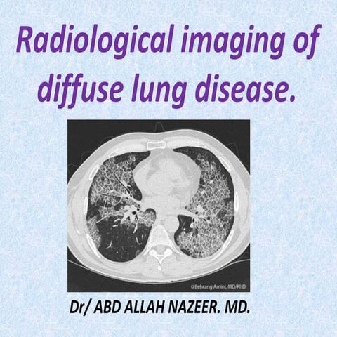 Presentation1.pptx, radiological imaging of diffuse lung disease.
