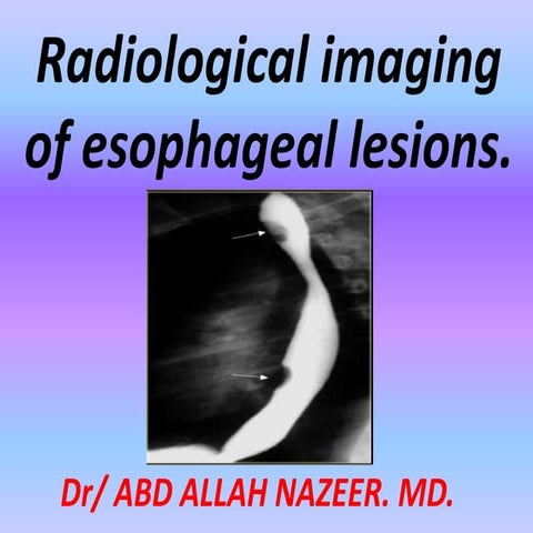 Presentation1.pptx, radiological imaging of esophageal lesions.