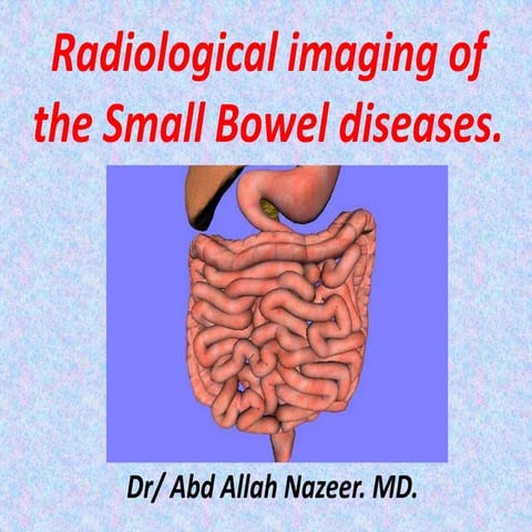 Presentation1.pptx, radiological imaging of small bowel disease.