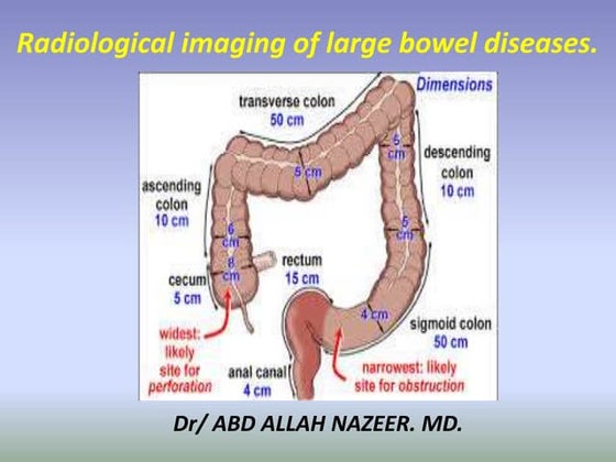 X Ray Normal Abdomen | PPT