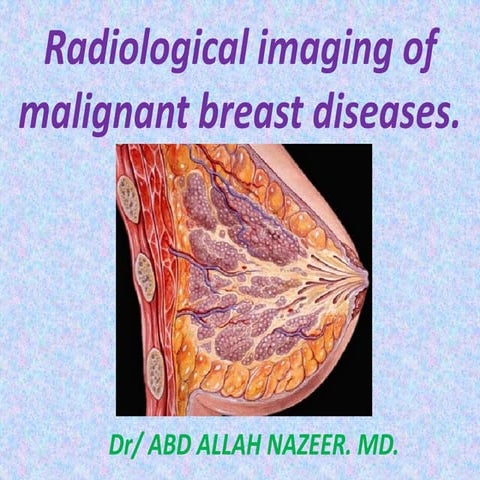 Presentation1.pptx, radiological imaging of malignant breast diseases.