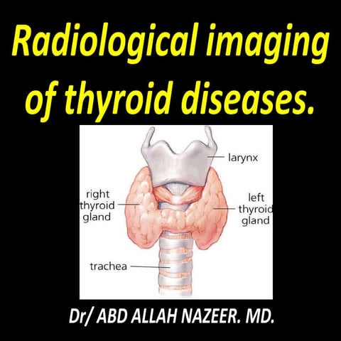 Presentation1.pptx, radiological imaging of the thyroid gland diseases ...