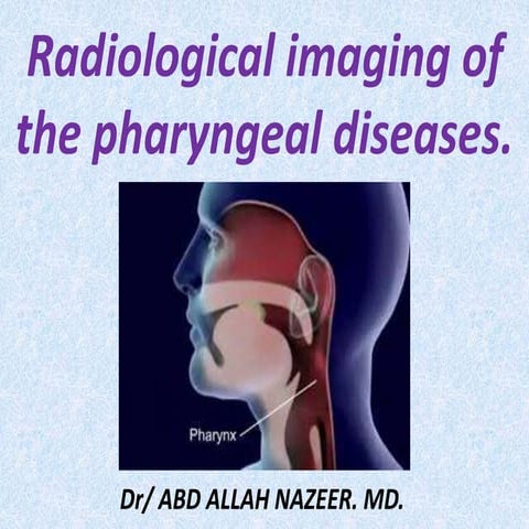 Presentation1.pptx, radiological imaging of the pharyngeal diseases
