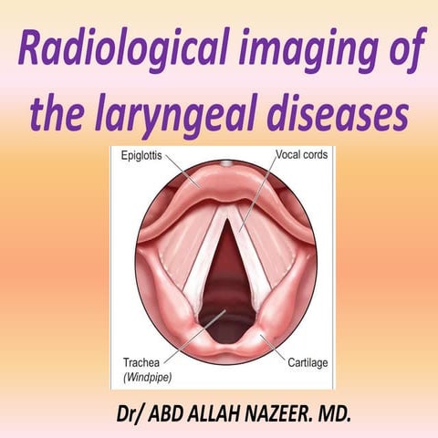 Presentation1.pptx, radiological imaging of the larngeal diseases.