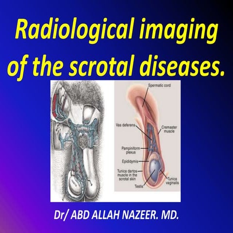 Presentation1.pptx, radiological imaging of scrotal diseases.