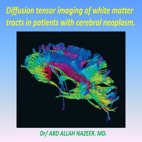 Presentation1.pptx, diffusion tensor imaging of white matter tract in cerebra...