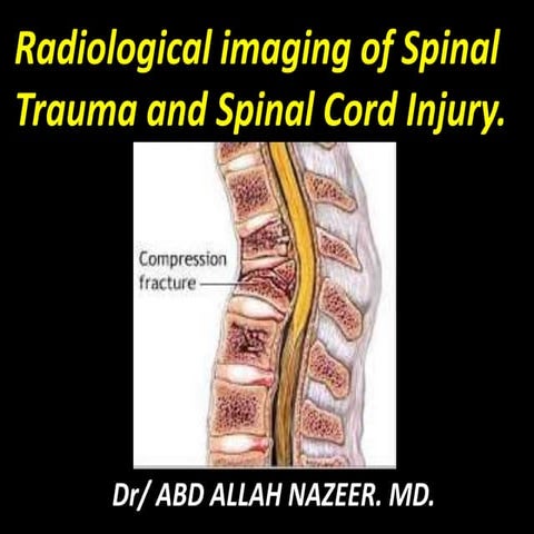 Presentation1.pptx, radiological imaging of spinal trauma and spinal cord inj...