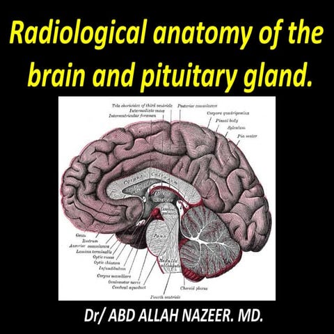 Presentation1.pptx, radiological anatomy of the brain and pituitary gland
