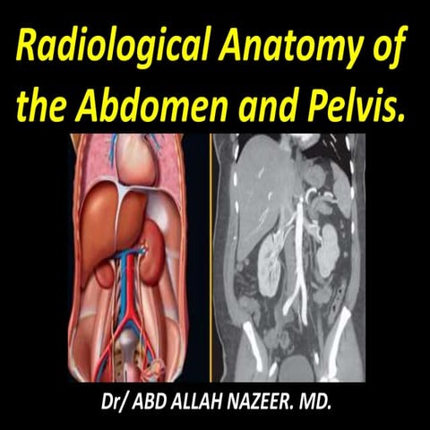 Presentation1.pptx, radiological anatomy of the abdomen and pelvis.