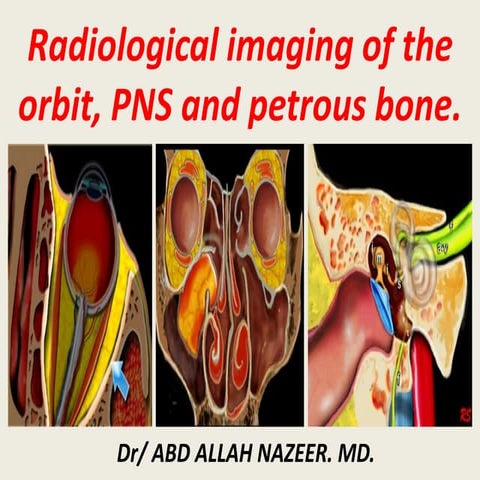 Presentation1.pptx, radiological anatomy of the orbits, pns and petrous bone.
