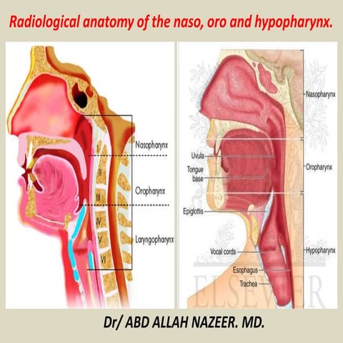 Presentation1.pptx, radiological anatomy of the naso, oro and hypopharynx.