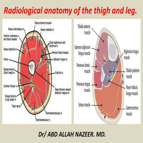 Presentation1.pptx, radiological anatomy of the thigh and leg.