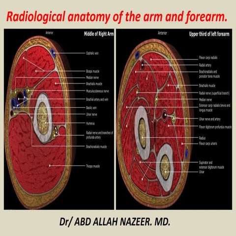 Upper limb radiology | PPTX