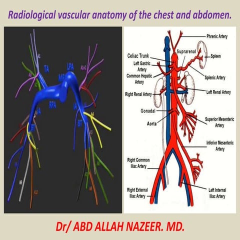 Presentation1.pptx, radiological vascular anatomy of the chest and abdomen.