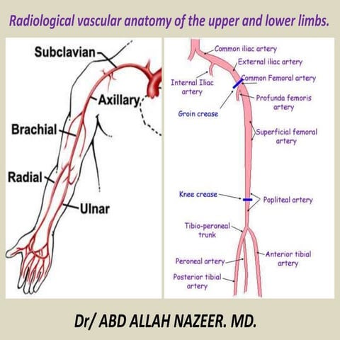 Presentation1.pptx, radiological vascular anatomy of the upper and lower limbs.