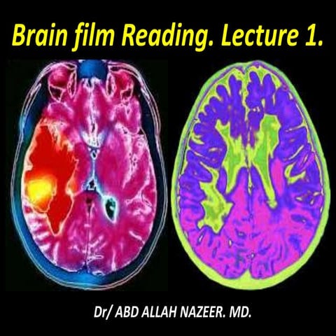 Presentation1.pptx, brain film reading, lecture 1.
