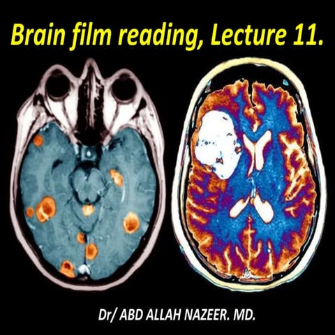 Presentation1.pptx, brain film reading, lecture 11.