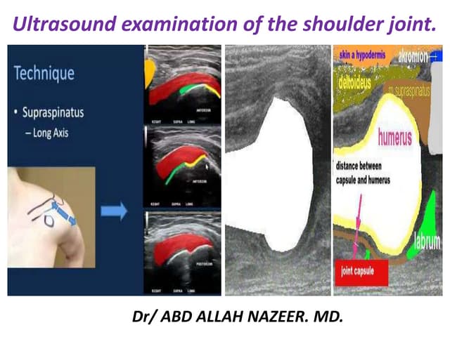Shoulder ultrasound report | PDF