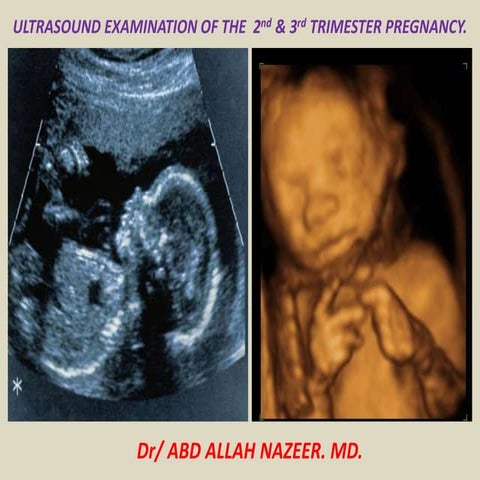 Presentation1.pptx, ultrasound examination of the 2nd & 3rd trimester pregnancy.