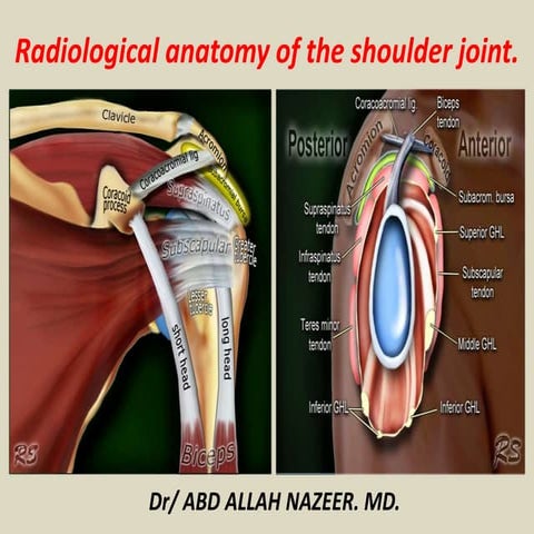 Presentation1.pptx, radiological anatomy of the shoulder joint.
