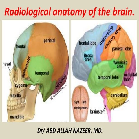 Presentation1.pptx, radiological anatomy of the brain.