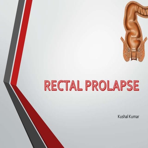 RECTAL PROLAPSE 