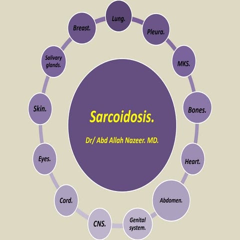 Presentation1.pptx, radiological imaging of sarcoidosis.