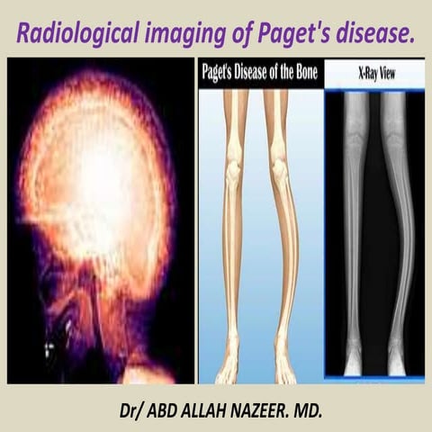 Imaging in rickets | PPTX