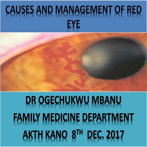 CAUSES AND MANAGEMENT OF RED EYES