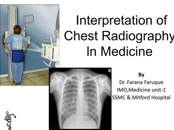 Chest decubitus | PDF