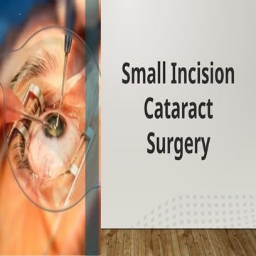 Cataract surgery | PPTX