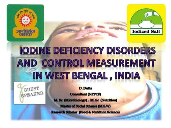 National iodine deficiency disorder control program | PPT