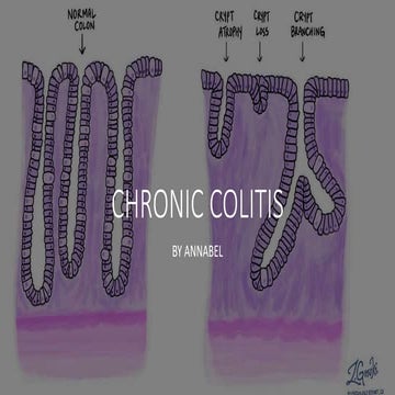 chronic colitis | PPTX