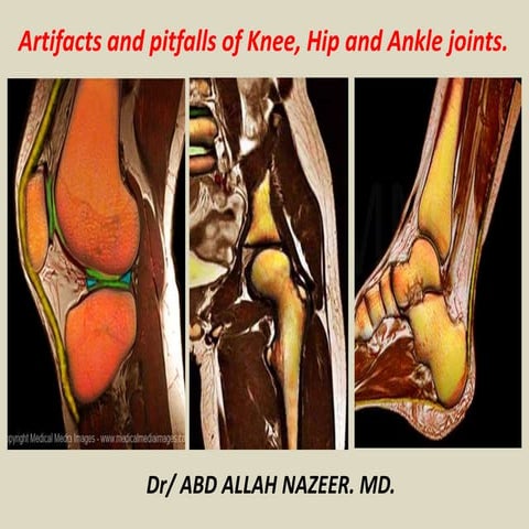 Presentation1, artifact and pitfalls of the knee, hip and ankle joints.