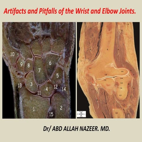 Presentation1, artifacts and pitfalls of the wrist and elbow joints.