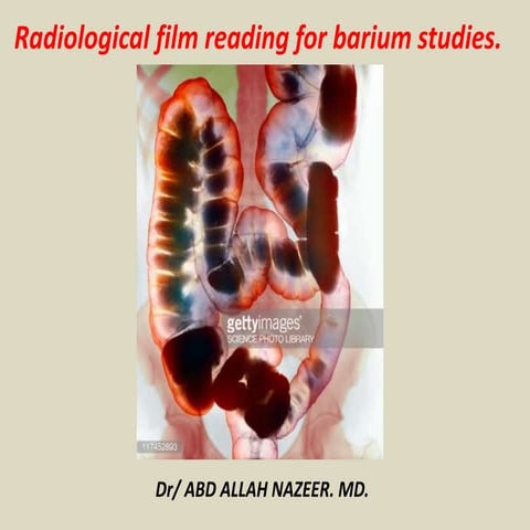 Presentation1, film readiing for barium studies. | PPTX