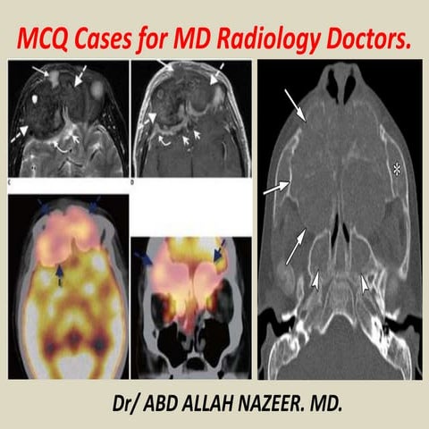Presentation1, MD MCQ Cases..pptx
