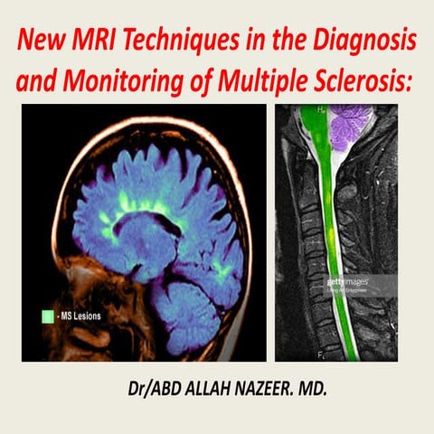 Presentation1, new mri techniques in the diagnosis and monitoring of multiple...