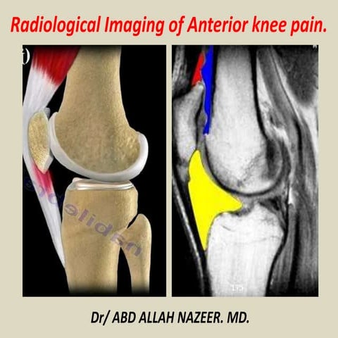 Presentation1, radiological imaging of anterior knee pain.