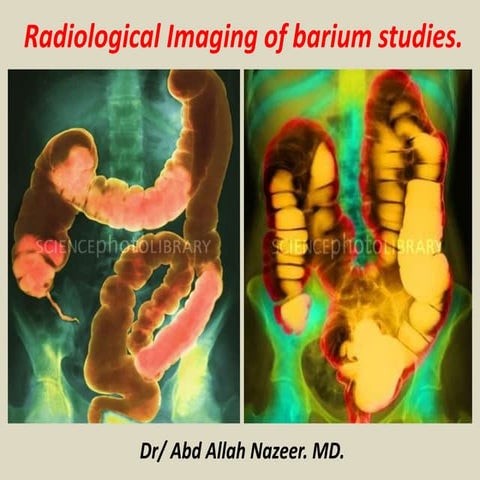Presentation1, radiological imaging of barium studies.