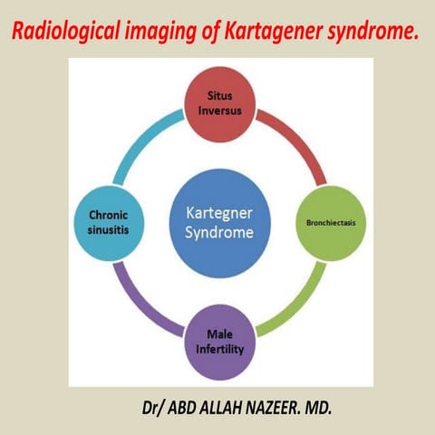 Presentation1, radiological imaging of karrtegner,s syndrome.