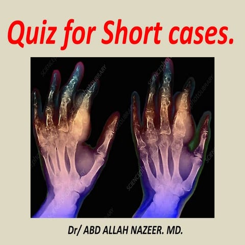 Presentation1, Short Cases Quiz..pptx