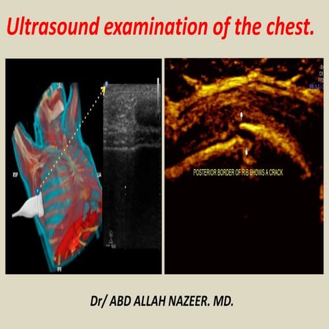 Presentation1, ultrasound examination of the chest.