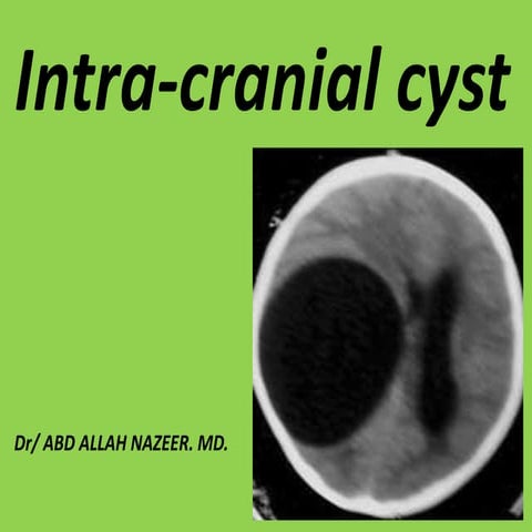 Presentation2.pptx intra cranial cyst