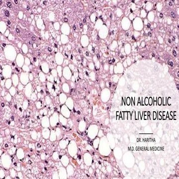 NON ALCOHOLIC FATTY LIVER DISEASE