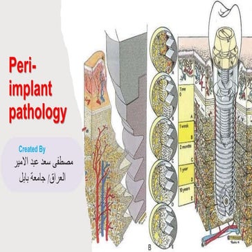 Peri-implant Diseases Classification, Cases Definition and Treatment.pdf
