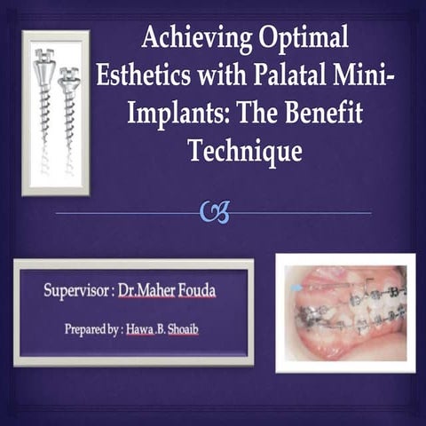 Achieving Optimal Esthetics with Palatal Mini-Implants: The Benefit Technique