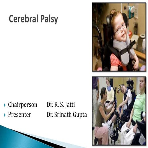 Presentation of cerebral palsy