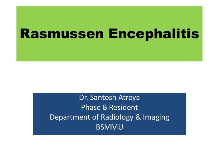 Rasmussen encephalitis in the eye of a Radiologist
