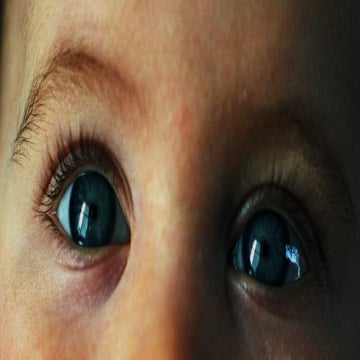 PRESENTATION ON OPTIC NERVES, NEURITIS, PAPILIA - Copy.pptx